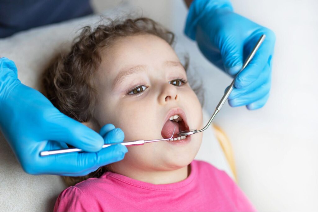 Tongue-Tie in Kids: Signs and Treatment Options